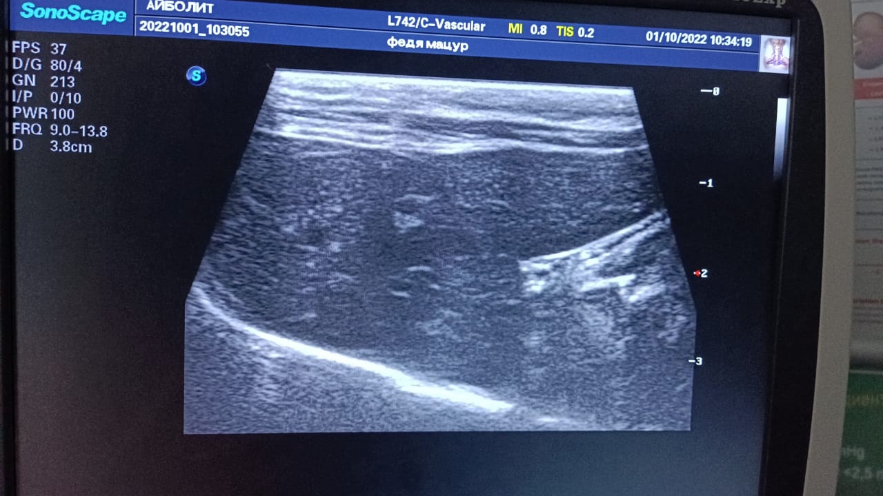 546A053C-4015-43C7-9492-E78C48D5C24D