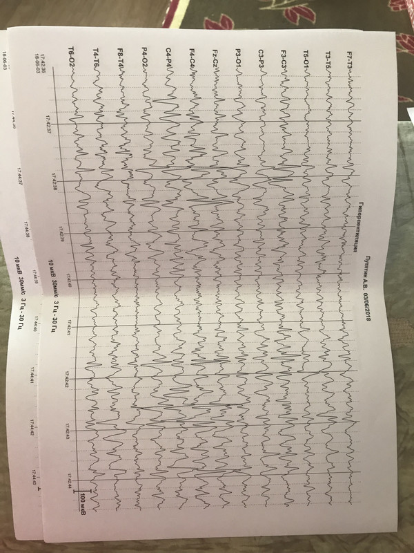 371C0329-DEF1-4360-8480-F57091D4DD74