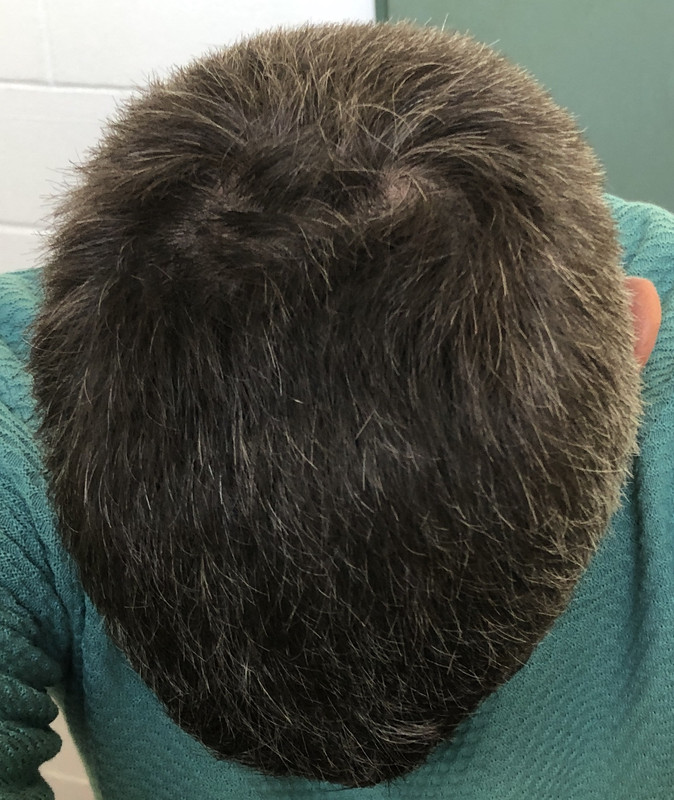 5EBA5AF6-9862-49D0-A597-8FD3F3C90620