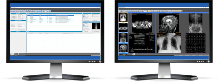Sante PACS Server PG 3.0.5 Sante PACS Server PG 3.0.5