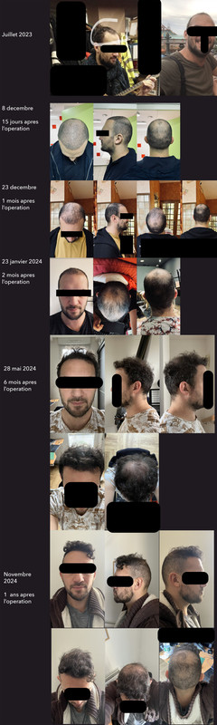 evolution_greffe (1)