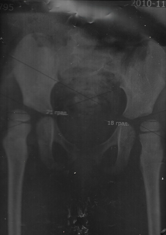 снимок от  2015u