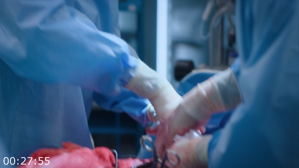 [Image: 83i9ibnmaa7c.png]