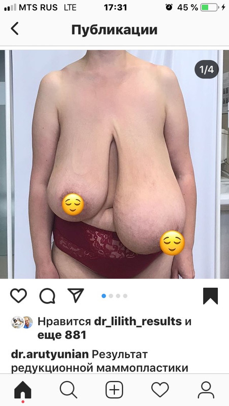 97F1CEE4-F4CA-4EA4-AFDE-ACE2238FD8CF