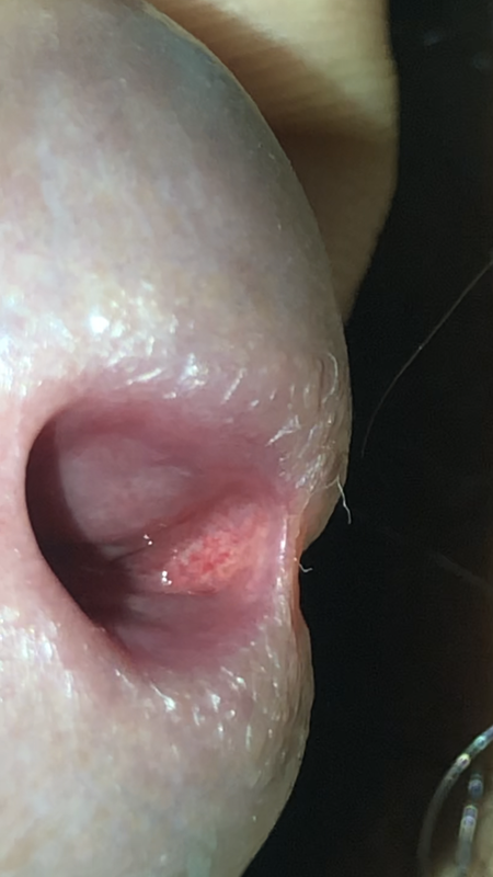 7AFC300A-D053-4246-A274-422FFB6AE281