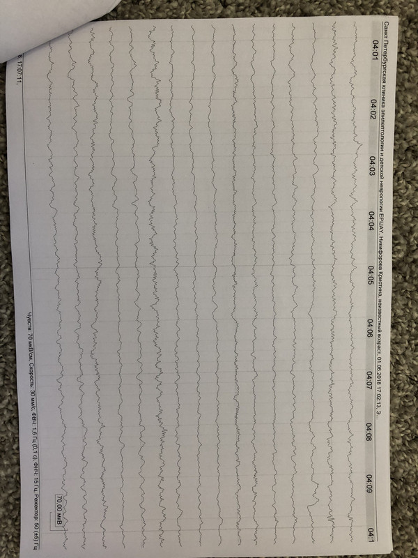 D39B2B20-9D84-4385-A535-3EA014DCB0C1