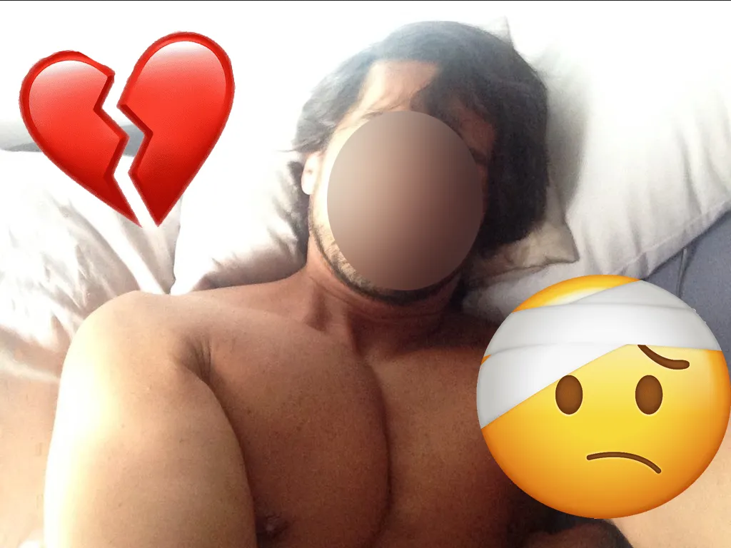 Actor de Televisa sufre terrible accidente en plena intimidad, esto pasó