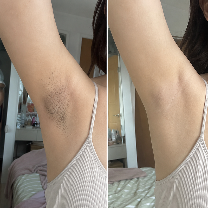 Customer skin result