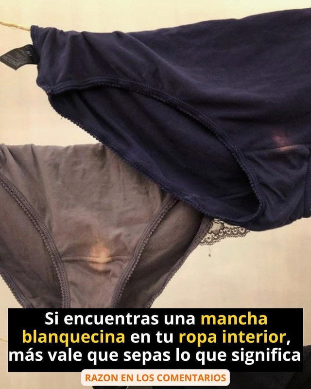 Manchas blanquecinas en ropa interior