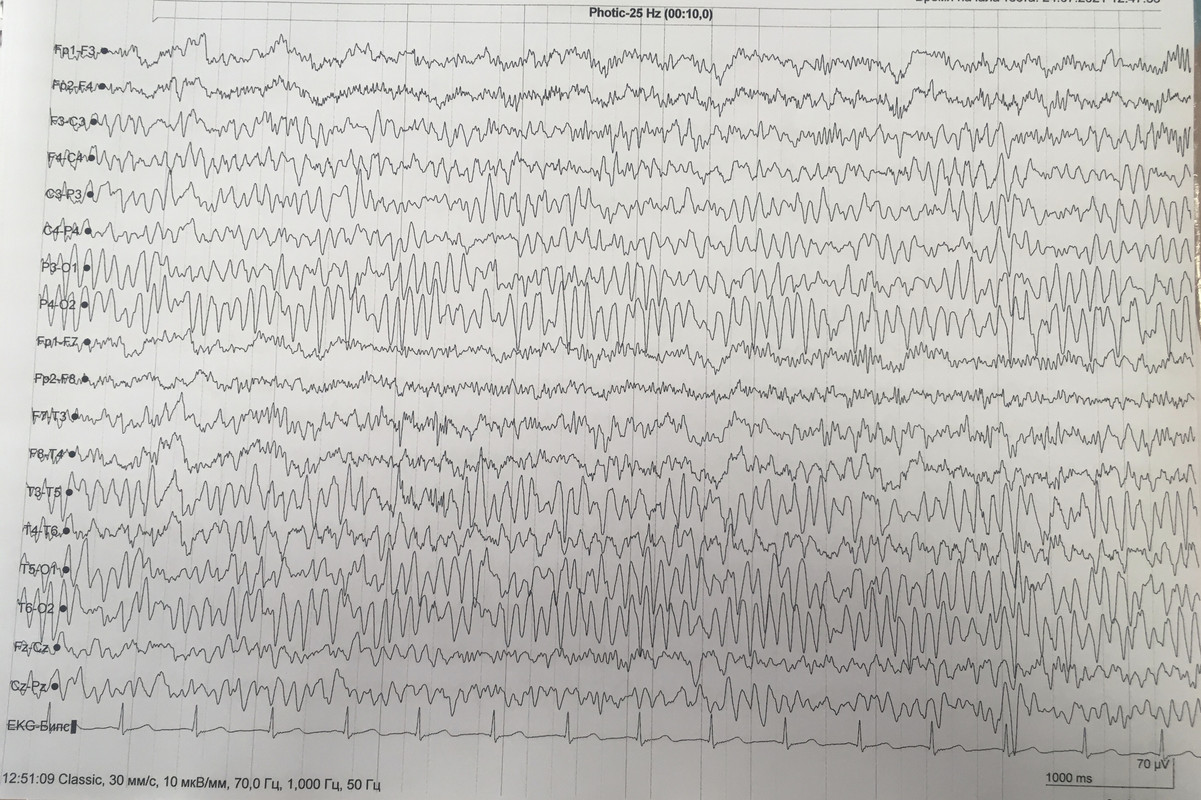 7EA5D255-6AA5-422D-A90C-41EF102C7E63