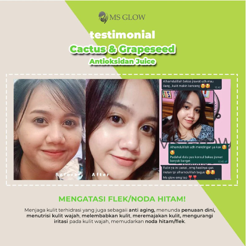 testimoni ms glow skin care