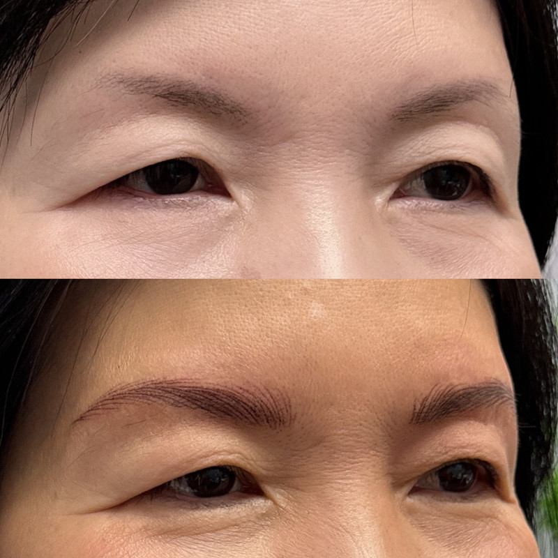 Eyebrow Enhancement Example 1