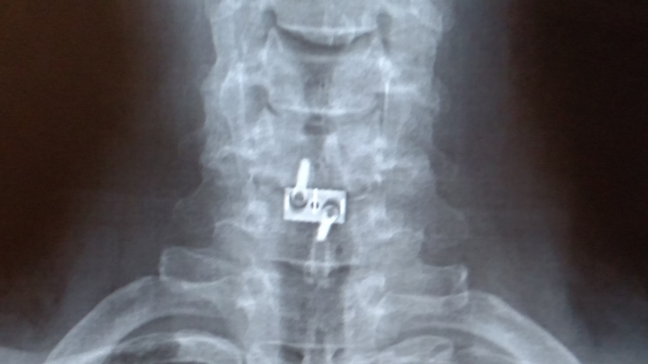 IMG_20190729_100107227