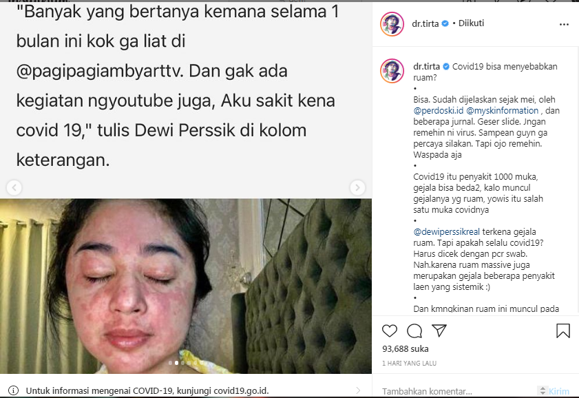dr Tirta beri tanggapan soal ruam yang muncul di wajah Dewi Perssik