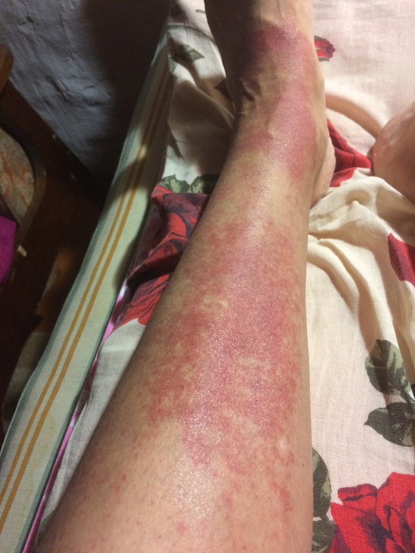 F12B4456-6387-47EC-ADBA-C635E9F82125