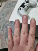 6-years-searching-for-diagnosis-just-found-multiple-v0-c888zlksxyod1