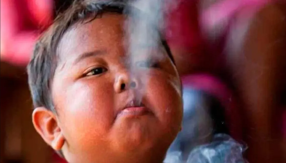 Así luce Aldi Rizal, el bebé de Indonesia que fumaba 40 cigarros al día