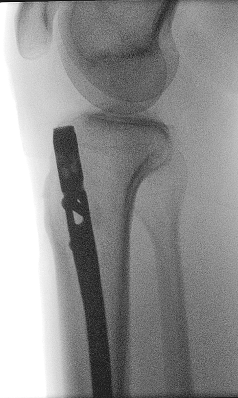 19 12 25 t standard 4