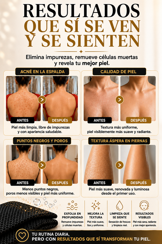 Imagen personalizada