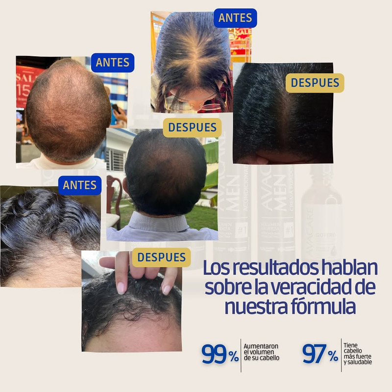 Botellas grandes del kit AVAWOMEN Therapy