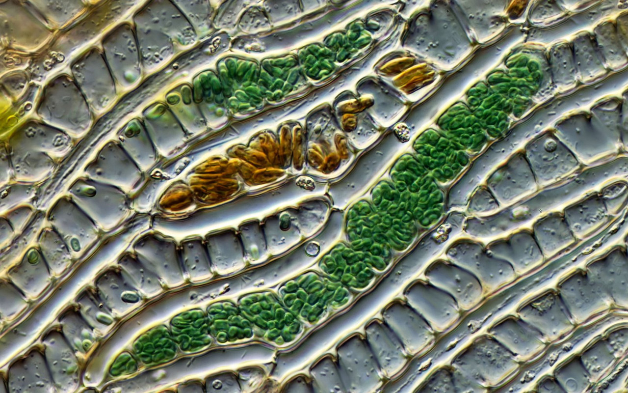 Aphanothece 02 (ev) sp Schleim-Blaualge in Sphagnum-Zellen DIK 100 Stack 3 Bodensatz