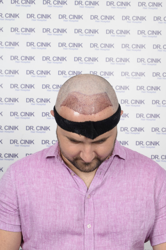 photos postopératoires (2)