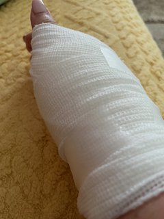 bandaged-hand-me-4th-aug-2025.jpg