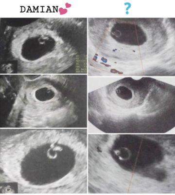 98376E7A-BA12-4CA4-BA7A-F898C69575F5