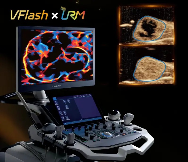 Ультразвукова кавітація та зображення з надвисокою роздільною здатністю забезпечили перший звіт про поєднання шляху оксиду азоту для боротьби з низькою перфузією та гіпоксією пухлин