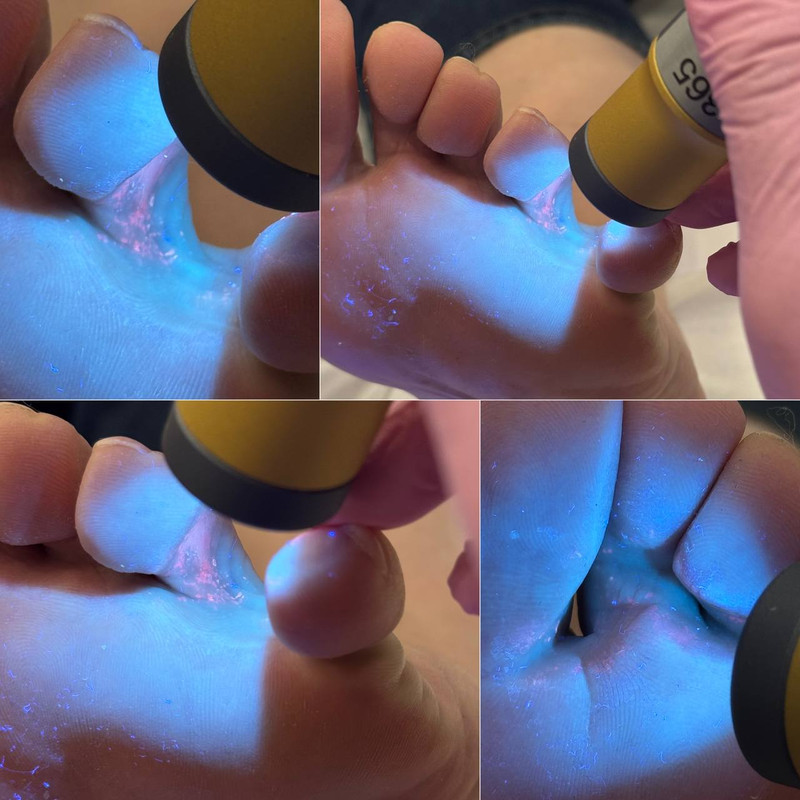 подология 3