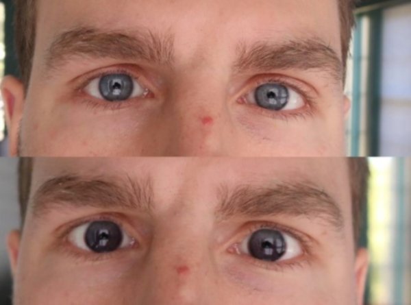Before-After-21