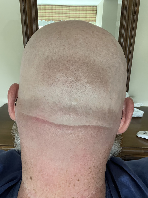 E927827D-07B8-456C-B98C-2980D49D0BBE