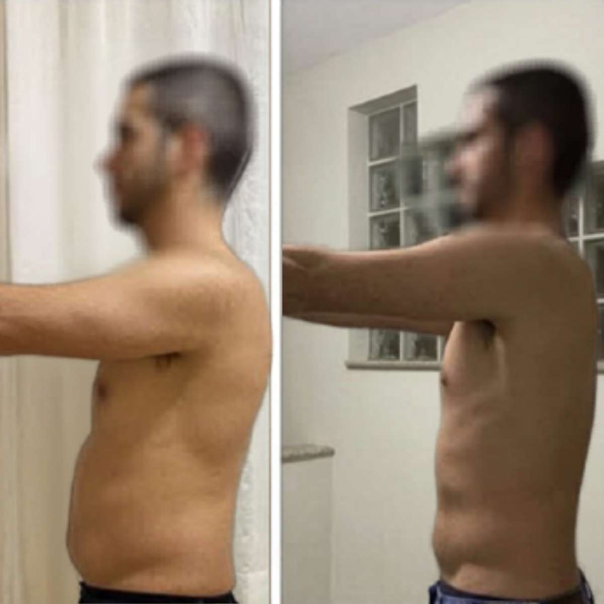 Antes e depois com ExxDrene HD 2