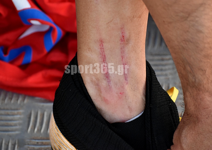 , &Tau;&epsilon;&lambda;&iota;&kappa;ό&sigmaf; &Kappa;&upsilon;&pi;έ&lambda;&lambda;&omicron;&upsilon; &Mu;&epsilon;&sigma;&sigma;&eta;&nu;ί&alpha;&sigmaf;: &Phi;&omega;&tau;&omicron;&rho;&epsilon;&pi;&omicron;&rho;&tau;ά&zeta; &alpha;&pi;&omicron; &tau;&eta;&nu; &Pi;&alpha;&rho;&alpha;&lambda;ί&alpha;