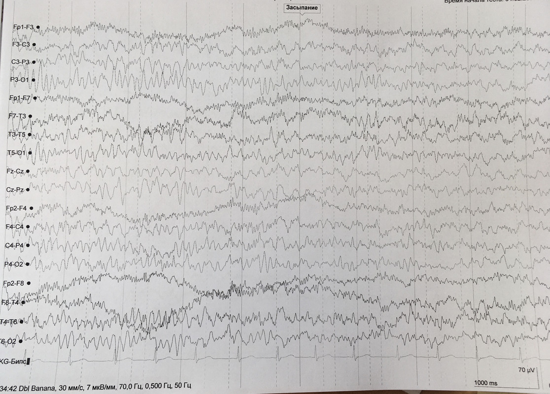 42415E79-79F8-4CA5-ADCF-8E76A8BAAEB5