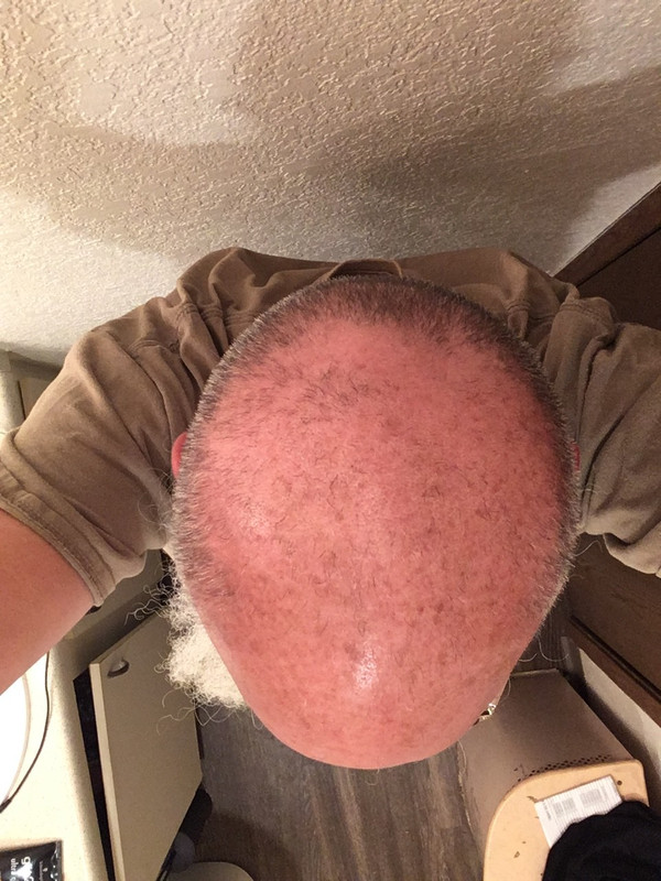 B614F6C8-CB0C-453D-BB5B-6C90C6AC540F