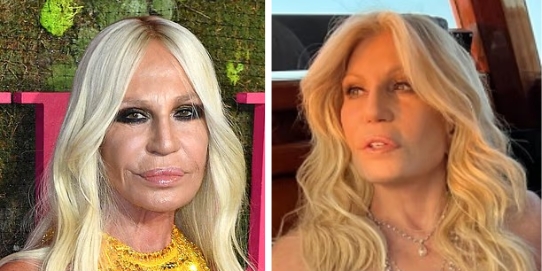The secrets behind Donatella Versace's face: Expert reveals how the fashion mogul, 70, has reversed her 'cosmetic procedures' as she shows off her fresh-faced new look