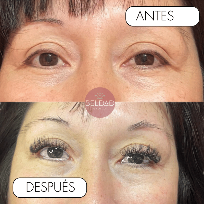 Antes y Después