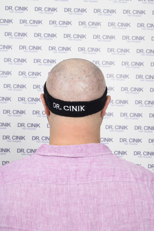 photos postopératoires (6)