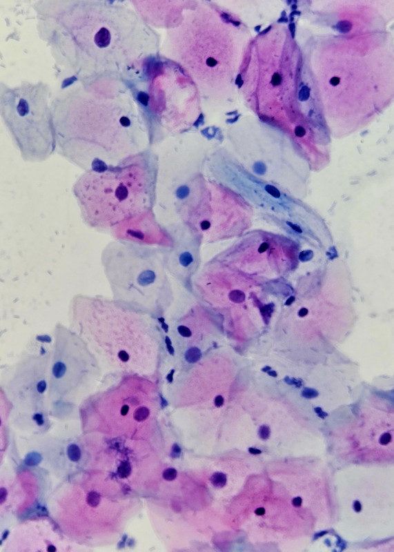 Área de Histopatología