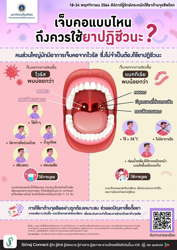 เจ็บคอแบบไหนถึงควรใช้ยาปฏิชีวนะ