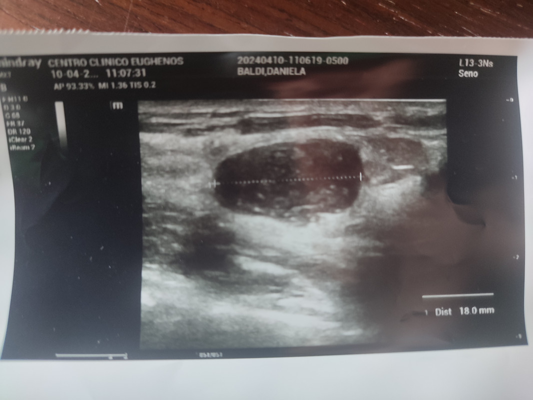 17149919080716444555492434832891