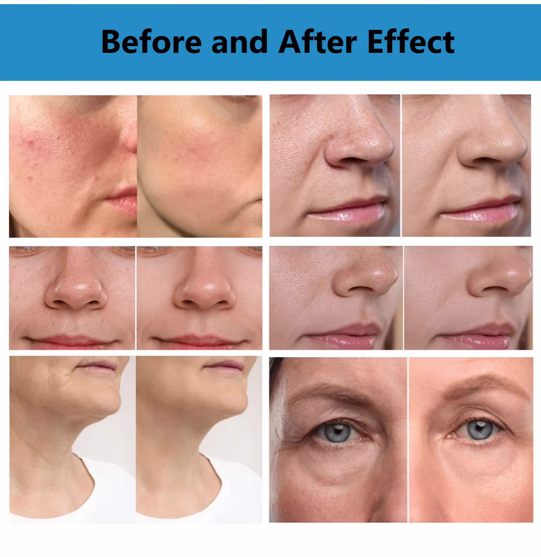 Description of the image