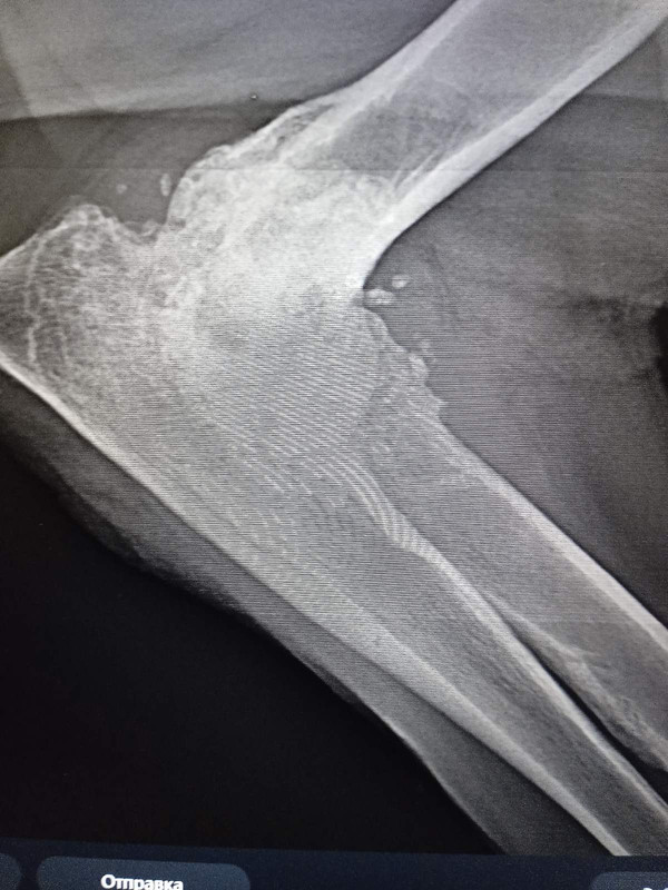 BAE29420-E5A7-4ED6-B10F-32E08ABC73BB