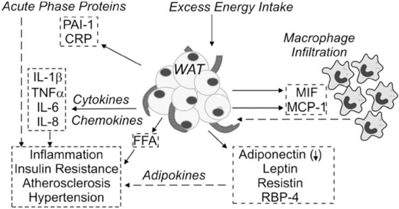 Figure 1: Saturated fatty acid–induced inflammatory pathways contributing to insulin resistance