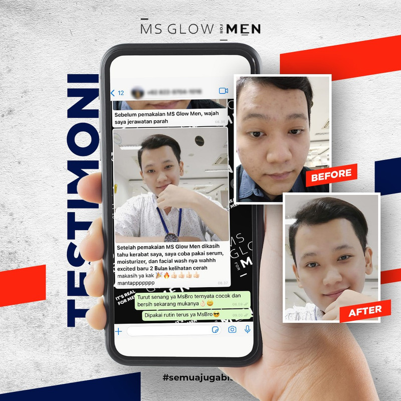 testimoni ms glow skin care