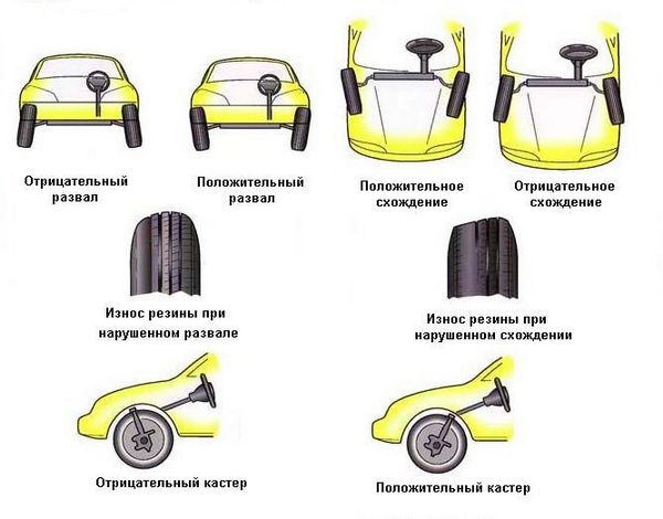 Процедура развал схождения - что это?