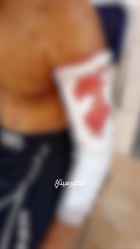 ALALI-L-00-17-15-15-Still013