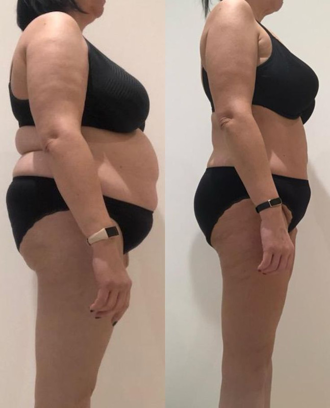 Transformación y Resultados Curvevera