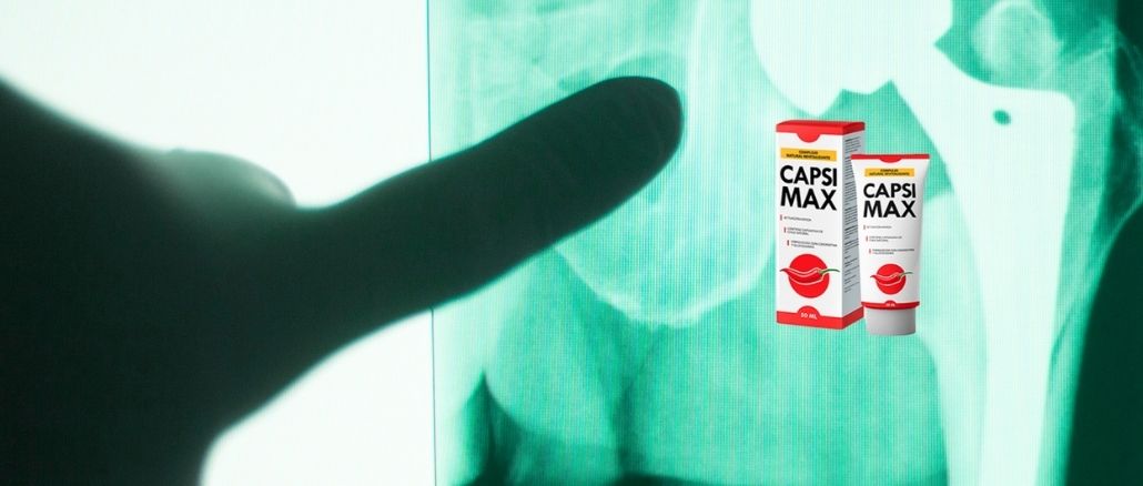 Capsimax gel para articulaciones - ¿Qué puedes encontrar en el foro?